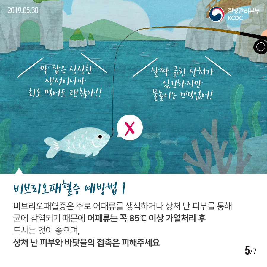 막 잡은 싱싱한 생선이니까 회로 먹어도 갠찮아!! 살짝 긁힌 상처가 있긴하지만 물놀이는 뜨떡없어!라고 생각하면 안돼요!
비브리오패혈증 예방법 1 - 비브리오패혈증은 주로 어패류를 생식하거나 상처 난 피부를 통해 균에 감염되기 때문에 어패류는 꼭 85℃ 이상 가열처리 후 드시는 것이 좋으며, 상처 난 피부와 바닷물의 접촉은 피해주세요