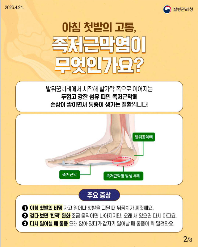 아침 첫발이 아프다면??? 족저근막염 관리 하자!!