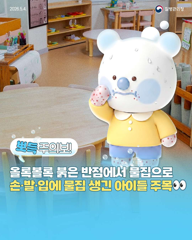 뽀득주의보! 손, 발, 입에 물집 생긴 아이들 주목!!