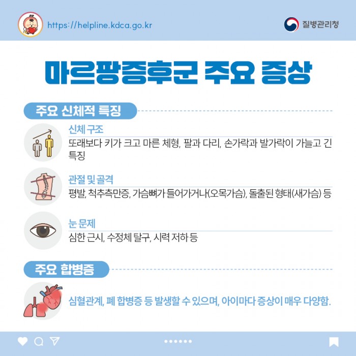 마르팡증후군