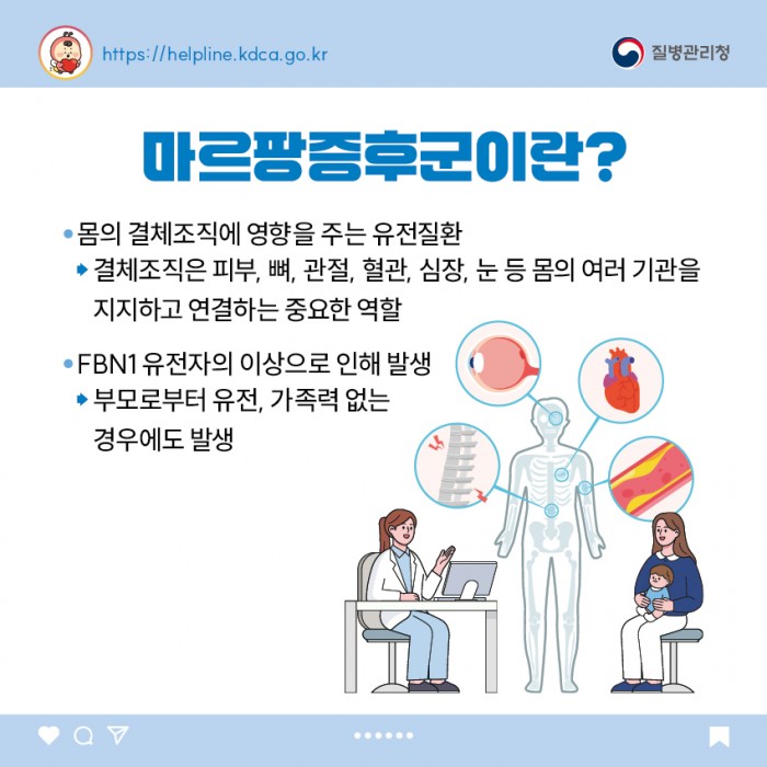 마르팡증후군
