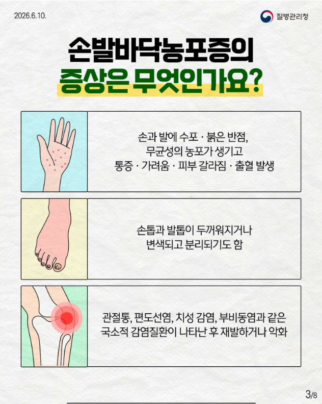 희귀질환 바로알기, 만성 염증성 피부질환 '손발바닥농포증'