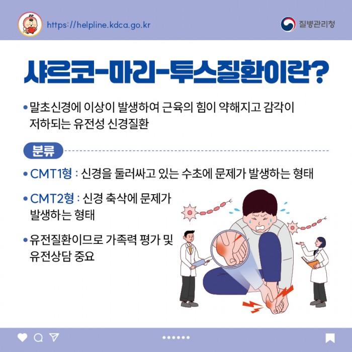샤르코-마리-투스질환