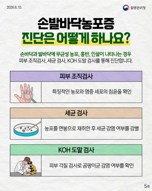 희귀질환 바로알기, 만성 염증성 피부질환 '손발바닥농포증'