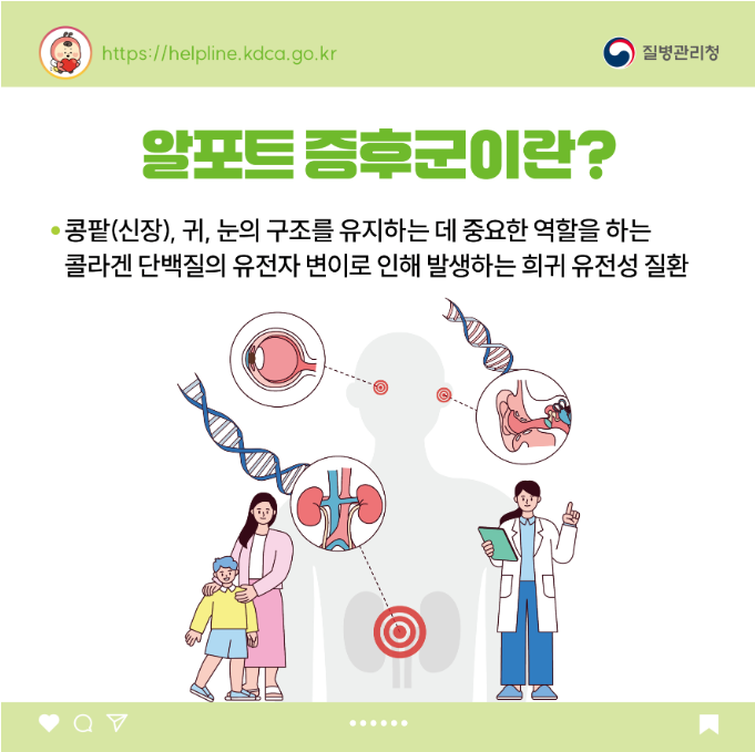 소아청소년 희귀질환 카드뉴스-알포트 증후군