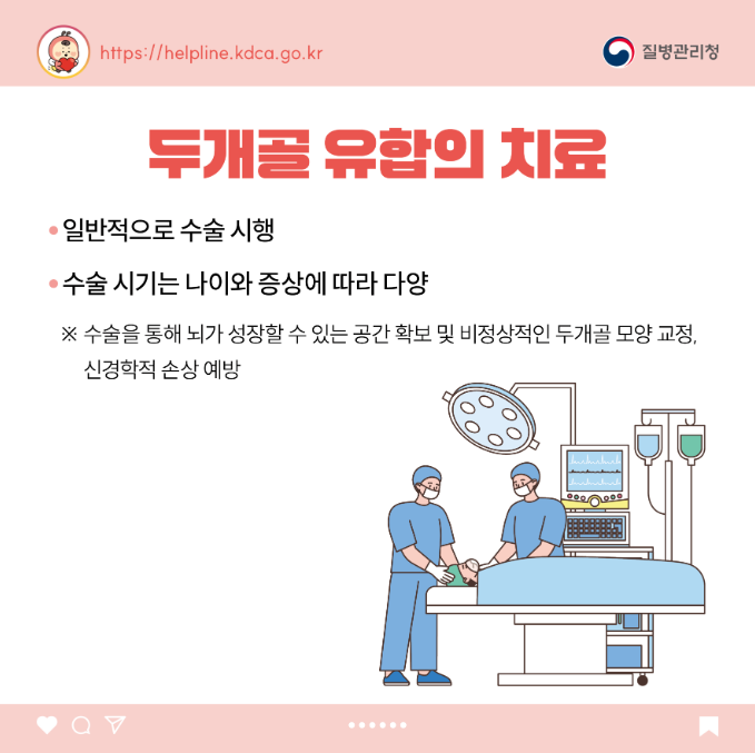 소아청소년 희귀질환 카드뉴스-두개골 유합