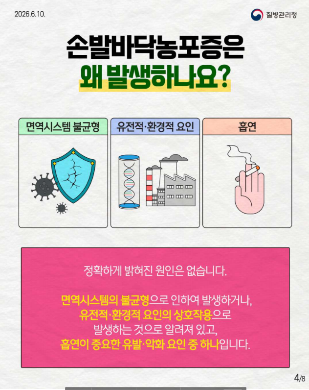 희귀질환 바로알기, 만성 염증성 피부질환 '손발바닥농포증'