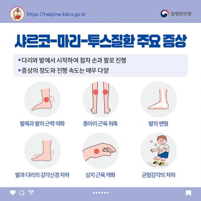 샤르코-마리-투스질환