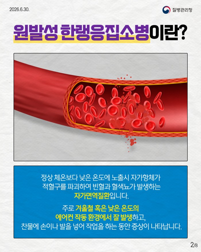 희귀질환 바로알기, 희귀 자가면역질환 '원발성한랭응집소병'