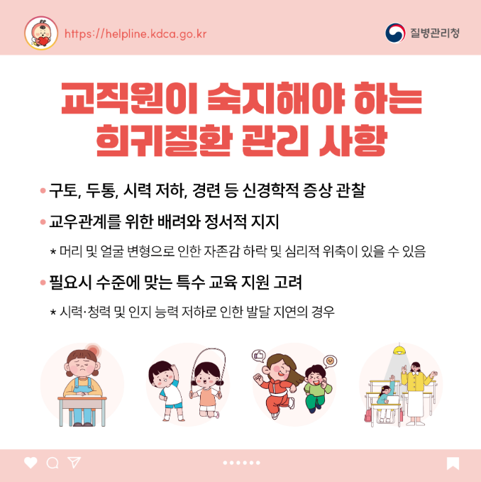 소아청소년 희귀질환 카드뉴스-두개골 유합