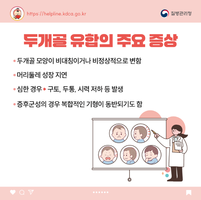 소아청소년 희귀질환 카드뉴스-두개골 유합