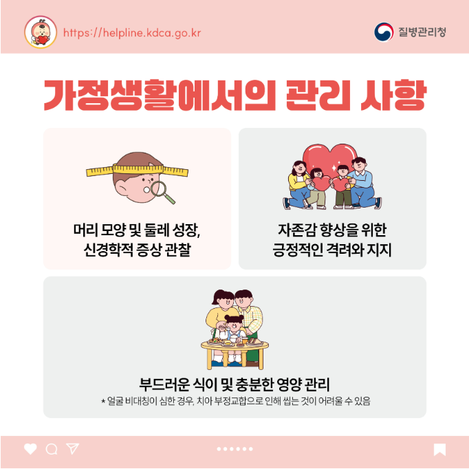소아청소년 희귀질환 카드뉴스-두개골 유합