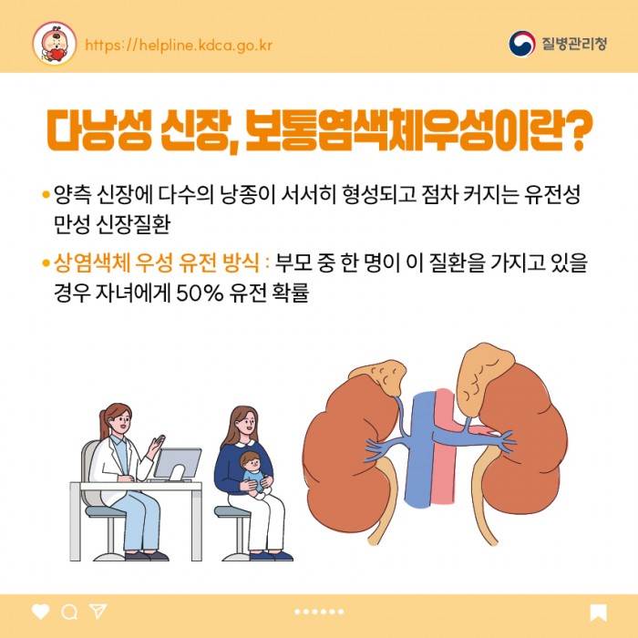 다낭성 신장, 보통염색체우성