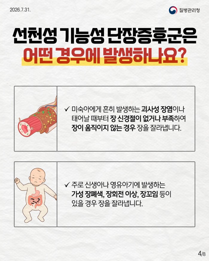 희귀질환 바로알기, 선천성 기능성 단장증후군