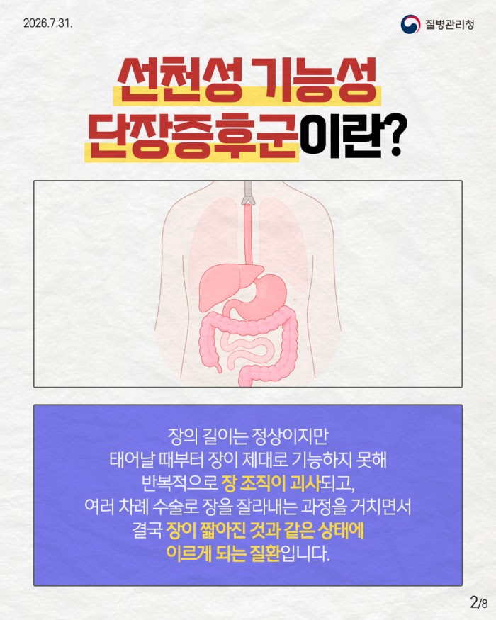 희귀질환 바로알기, 선천성 기능성 단장증후군