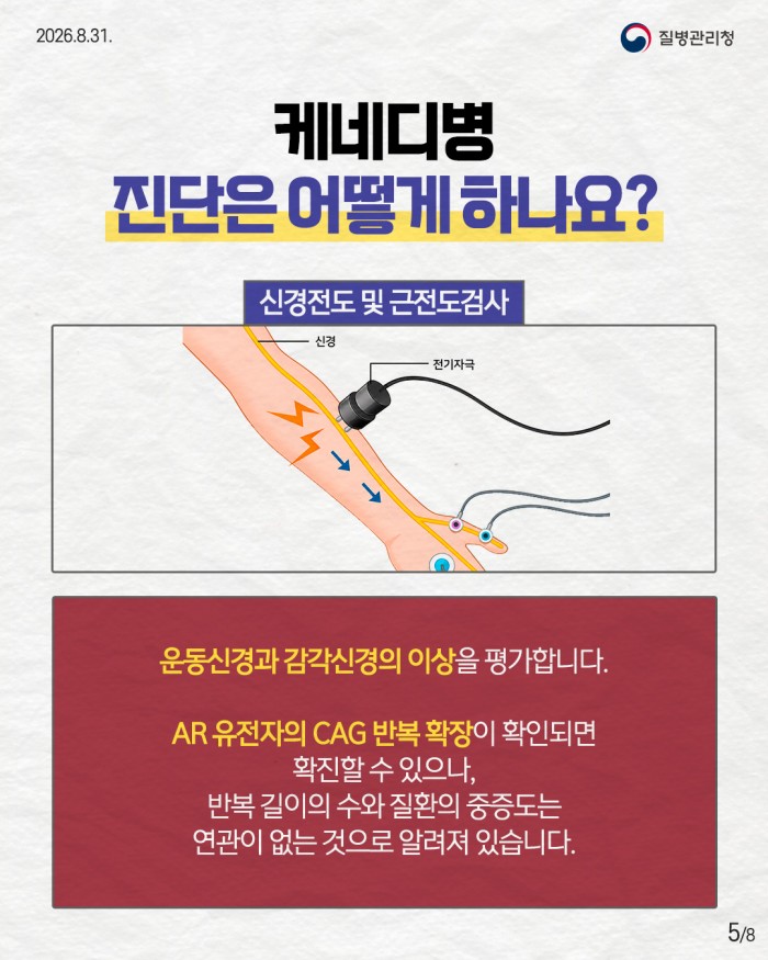 희귀질환 바로알기, 케네디병