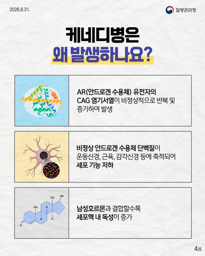 희귀질환 바로알기, 케네디병