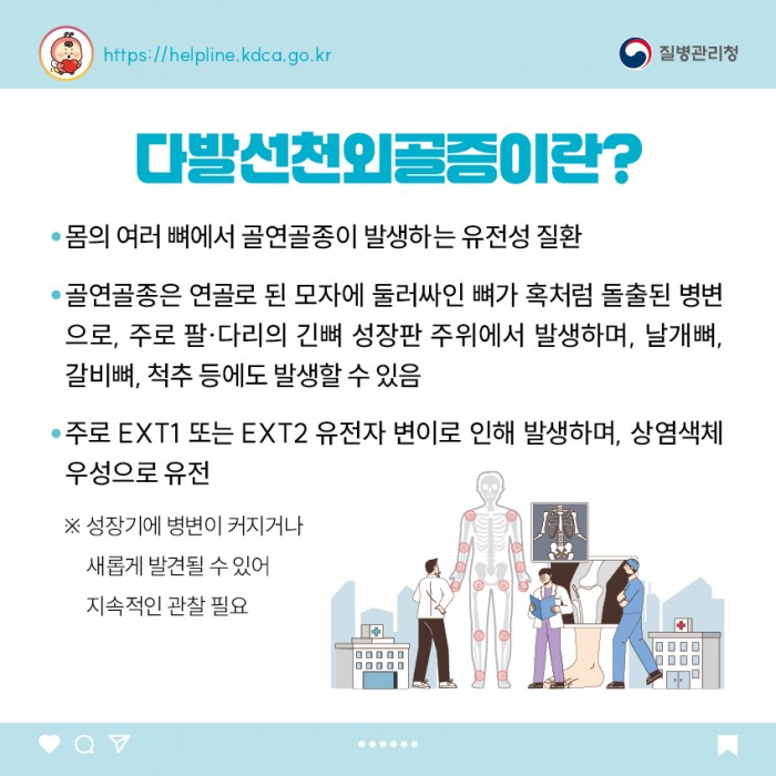 희귀질환 - 다발선천외골증