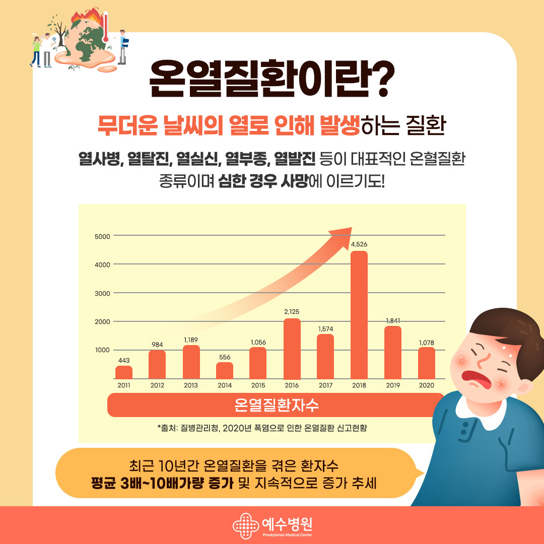 온열질환이란? 더운 날씨의 열로 인해 발생하는 질환 열사병, 열탈진, 열실신, 열부종, 열발진 등이 대표적인 온혈질환 종류이며 심한 경우 사망에 이르기도! 온열질환지수 출처:질병관리청, 2020폭염으로 인한 온열질환 신고현황
2011년 443
2012년 984
2013년 1189
2014년 556
2015년 1056
2016년 2125
2017년 1574
2018년 4526
2019년 1841
2020년 1078