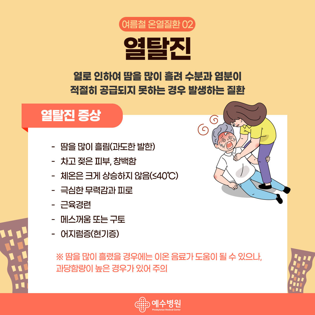 여름철 온열질환02 열탈진: 열로인하여 땀을 많이 흘려 수분과 염분이 적절히 공급되지 못하는 경우 발생하는 질환 ,열탈진 증상: 땀을 많이 흘림(과도한 발한),차고젖은 피부, 창백함, 체온은 크게 상승하지 않음 (40도 이하)
,극심한 무력감과 피로, 근육경련, 메스꺼움 또는 구토, 어지럼증(현기증) *땀을 많이 흘렸을 경우에는 이온음료가 도움이 될 수 있으나, 과당함량이 높은 경우가 있어 주의 
