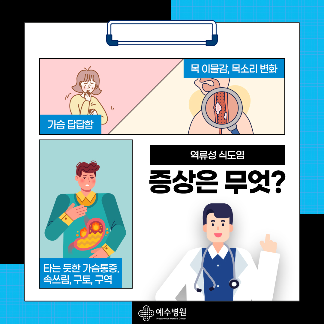 역류성 식도염 증상은 무엇? 가슴답답함, 목 이물감, 목소리 변화, 타는 듯한 가슴통증, 속쓰림, 구토, 구역