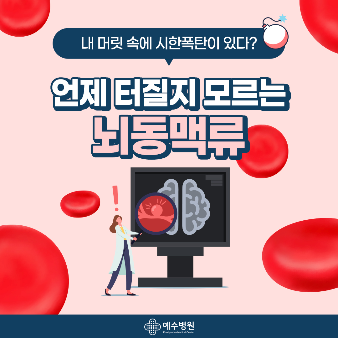 내 머릿 속에 시한폭탄이 있다? 언제 터질지 모르는 뇌동맥류