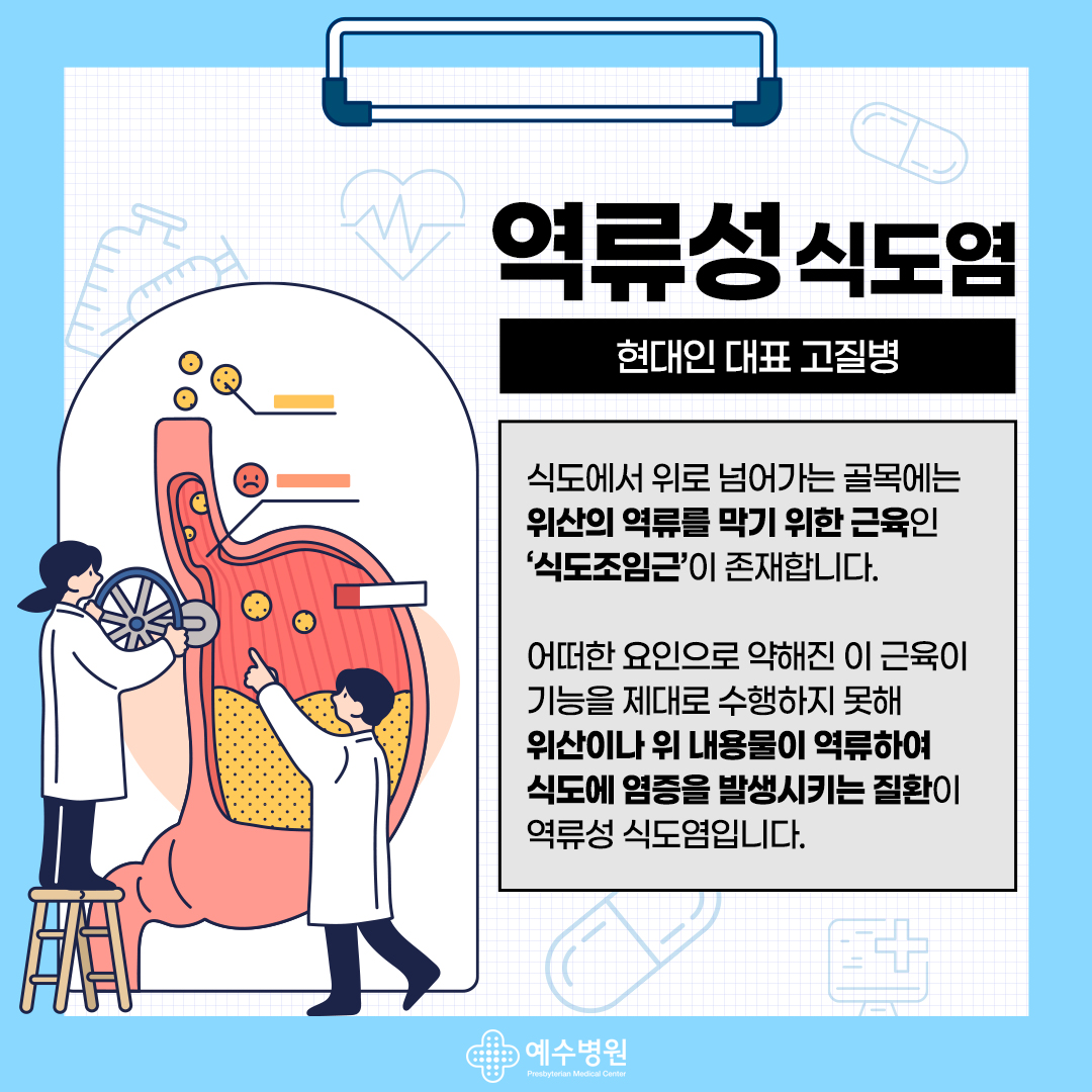 역류성 식도염-현대인 대표 고질병 : 식도에서 위로 넘어가는 골목에는 위산의 역류를 막기 위한 근육인 