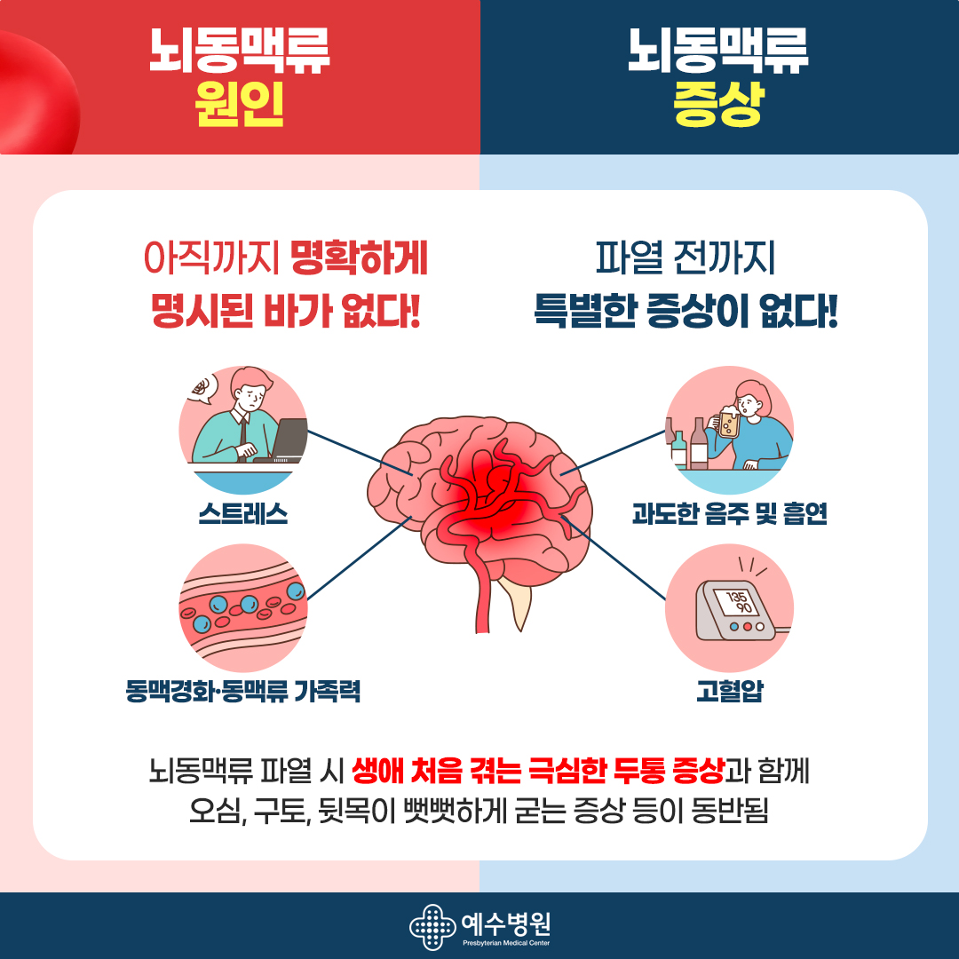 뇌동맥류 원인 : 아직까지 명확하게 명시된 바가 없다! 스트레스, 동맥경화와 동맥류 가족력. 뇌동맥류 증상 : 파열 전까지 특별한 증상이 없다! 과도한 음주 및 흡연, 고혈압. 뇌동맥류 파열 시 생애 처음 겪는 극심한 두통 증상과 함께 오심, 구토, 뒷목이 뻣뻣하게 굳는 증상 등이 동반됨