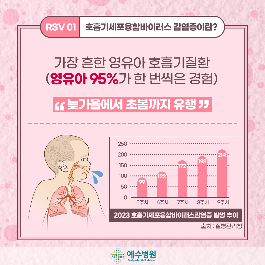 RSV01-호흡기 세포융합바이러스 감염증이란? 가장 흔한 영유아 호흡기 질환(영유가 95%가 한 번씩은 경험) 늦가을에서 초봄까지 유행 / 2023 호흡기세포융합바이러스감염증 발생 추이: 5주차(99명), 6주차(122명), 7주차(172명), 8주차(198명), 9주차(214명), 출처 : 질병관리청