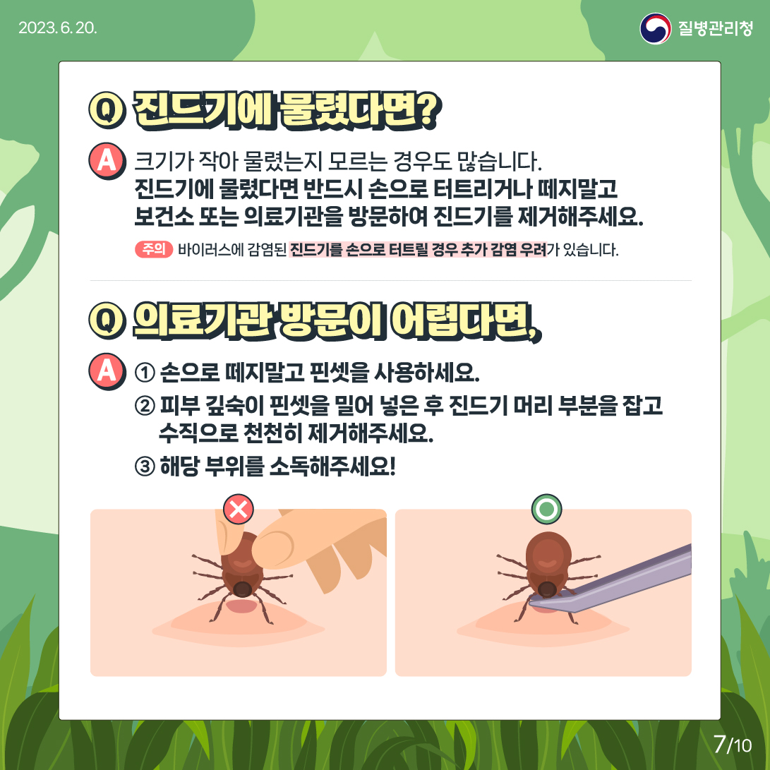  Q 진드기에 물렸다면? A 크기가 작아 물렸는지 모르는 경우도 많습니다. 진드기에 물렸다면 반드시 손으로 터트리거나 떼지말고 보건소 또는 의료기관을 방문하여 진드기를 제거해주세요. *주의 (바이러스에 감염된 진드기를 손으로 터트릴 경우 추가 감염 우려가 있습니다.) Q 의료기관 방문이 어렵다면, A 1번 손으로 떼지말고 핀셋을 이용하세요. 2번 피부 깊숙이 핀셋을 밀어 넣은 후 진드기 머리 부분을 잡고 수직으로 천천히 제거해주세요. 3번 해당 부위를 소독해주세요!