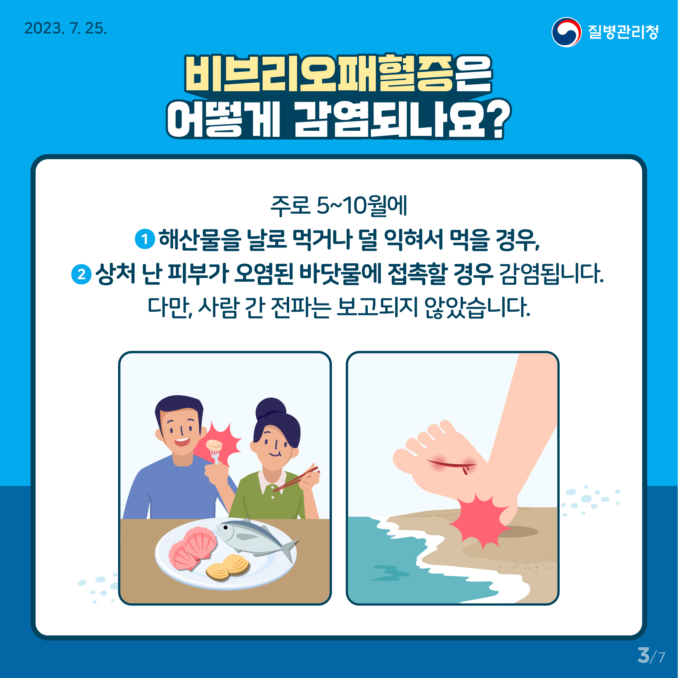 비브리오패혈증은 어떻게 감염되나요? 주로 5~10월에 (1번 해산물을 날로 먹거나 덜 익혀서 먹을 경우, 2번 상처 난 피부가 오염된 바닷물에 접촉할 경우 감염됩니다. 다만, 사람 간 전파는 보고되지 않았습니다.)