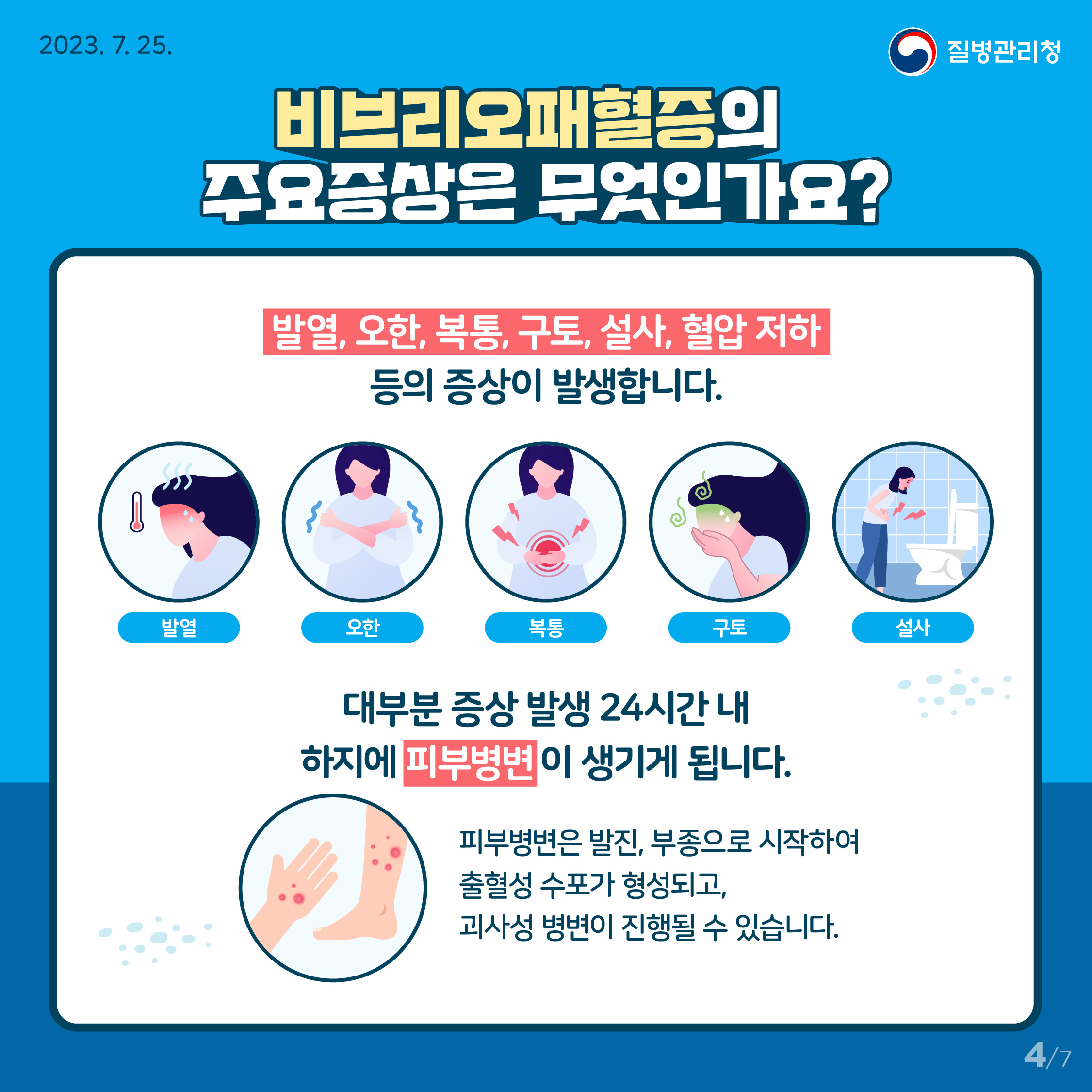 비브리오패혈증의 주요증상은 무엇인가요? 발열, 오한, 복통, 구토, 설사, 혈압 저하 등의 증상이 발생합니다. 대부분 증상 발생 24시간 내 하지에 피부병변이 생기게 됩니다. 피부병변은 발진, 부종으로 시작하여 출혈성 수포가 형성되고, 괴사성 병변이 진행될 수 있습니다.